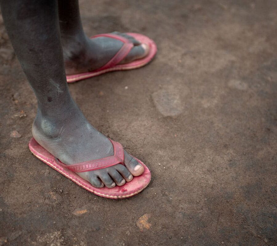 Støvete føtter med rosa sandaler står på en leirete, tørr bakke. Bildet blir brukt som en illustrasjon i artikkel Ny voldsbølge rammer Kongo. Foto SOS-barnebyer