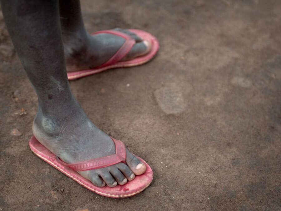 Støvete føtter med rosa sandaler står på en leirete, tørr bakke. Bildet blir brukt som en illustrasjon i artikkel Ny voldsbølge rammer Kongo. Foto SOS-barnebyer