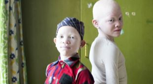 SOS-barnebyer driver en barneby i utkanten av Dar Es-Salaam, og her har et søskenpar med albinisme, storesøster Mela (9) og lillebror Abu (7), funnet et trygt hjem og god omsorg etter en tøff start på livet. Foto: Lars Just